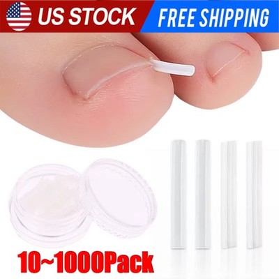 10pcs/set Ingrown Nail Pad Ortho Nail Filling Nail Groove Pad Corrector Artifact