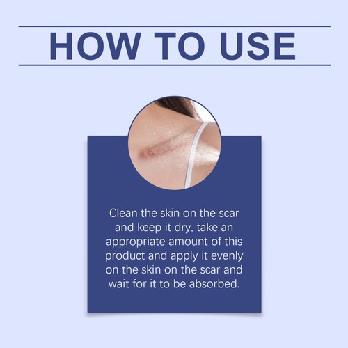 1-5X Silicone Scar Gel Stretch Marks Removal Cream Advanced Surgery Scar Care - Picture 4 of 16