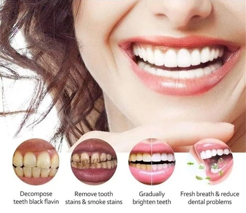 2PCS MIYANXI Polvere Sbiancante Denti, MIYANXI Polvere Denti Macchia Rem 50g - Foto 3 di 5