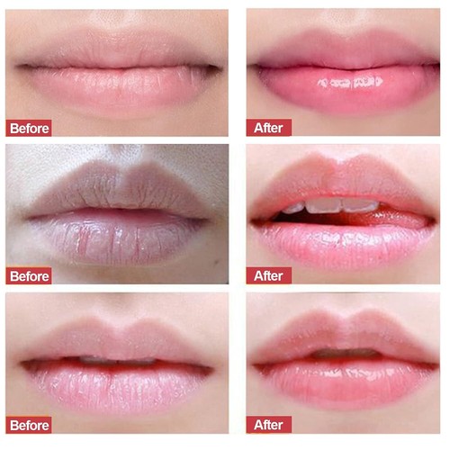 Strawberry Lip Care Scrub & Mask For Dark Lips Sleeping Lip Mask - 20gm
