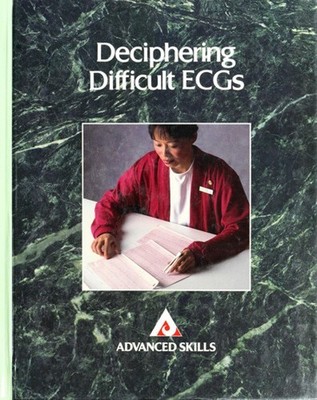 Deciphering Difficult ECGs Hardcover Springhouse Publishing Compa