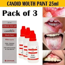 CANDID MOUTH PAINT FOR ORAL THRUSH TREATMENT FOR KILLS FUNGAL INFECTION 3 PACK