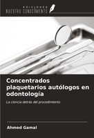Concentrados Plaquetarios AutóLogos En OdontologíA Ahmed Gamal