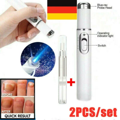 MARKENLOS Laserstift Anti-Pilz Nagel Behandlung Finger Care Behandlung Pen Nail Treatment.