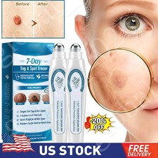 3X Tag Spot Eraser Mole Skin Tags Removal Tool Eraser Pen Painless Long-Lasting