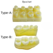 Dental Molar Caries Decay Teeth Model Composite Resin Restore Tooth Simulat