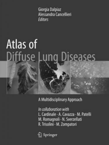 Thumbnail - Atlas Of Diffuse Lung Diseases A Multidisciplinary Approach 5311