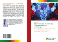 CâNcer De Colo Do úTero E A Citopatologia ApóS Radioterapia Ruan Silva