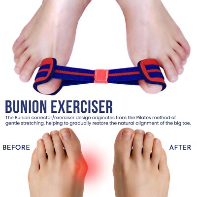Bunion Exerciser Big Feet Zehenausrichtung Glätteisen Gurtspannung Hallux Gerät