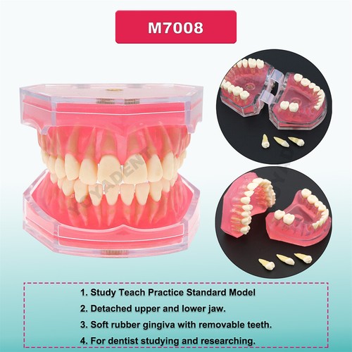 Multiple Types Dental Teeth Model Ortho Implant Practice Teaching Demo Model - Picture 115 of 276