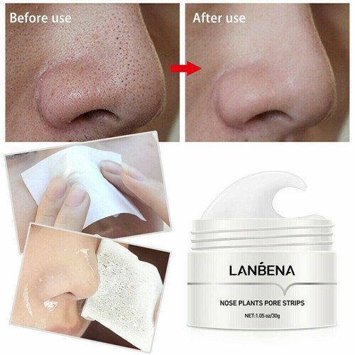 LANBENA Blackhead Remover Cream Facial Nose Mask Plant Pore Strips Acne Peel Off - Picture 4 of 12