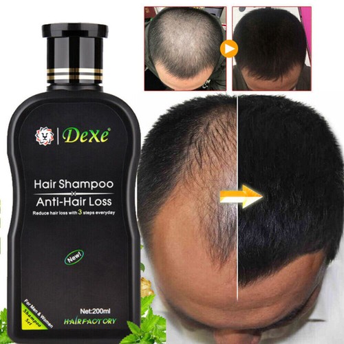 200ml Regeneration Nachwachsen Haarwachstum Shampoo Natürliche Anti Haarausfall Behandlung - Bild 1 von 13
