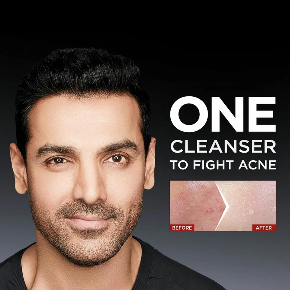 Garnier Hombres, Jabón Facial Anti-Espinillas, Repara Piel y Equilibra Aceites, AcnoFight, 100 Foto 4 de 4