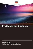ProthèSes Sur Implants Arpit Sikri