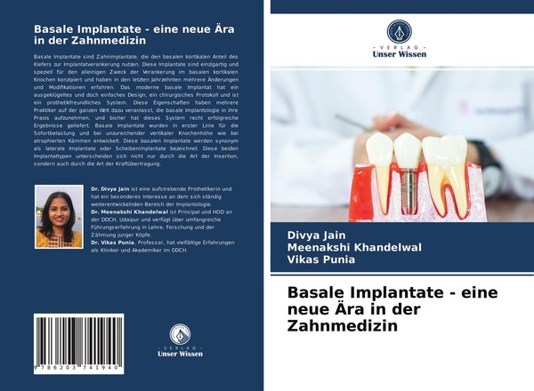 Basale Implantate - Eine Neue ÄRa In Der Zahnmedizin Divya Jain-image