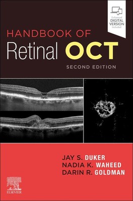 Handbook of Retinal OCT | Optical Coherence Tomography | Jay S. Duker (u. a.)