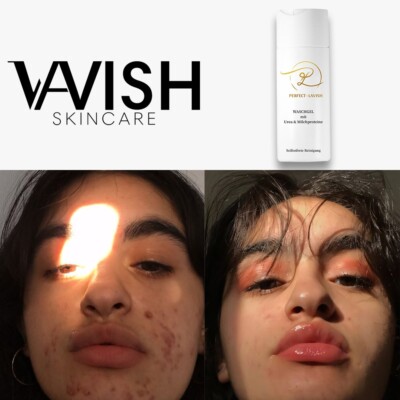 LAVISH Skincare, Waschgel mit Milchprotein & Urea, Gesichtsreinigung