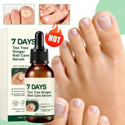 Tea Tree Ginger Nail Treatment Oil Thickened Nails Nail Repair Serum Nail Care