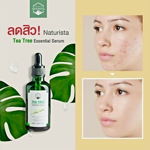 smoothing serum for acne skin