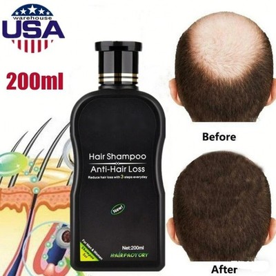 Hair Growth Shampoo Hair Regrowth Treatment Anti-Hair Loss Shampoo For Men Women