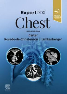 ExpertDDx: Chest Carter Rosado-de-Christenson Lichtenberger III Hardback 2e