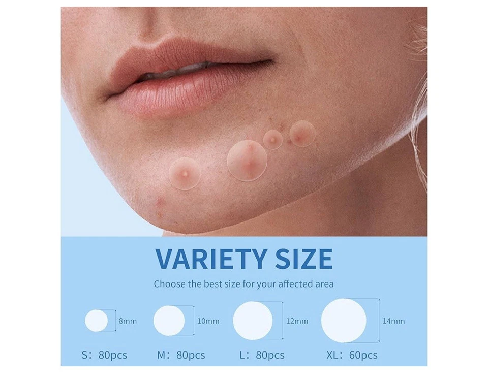 Pimple Patches for Face, 4 Size 300 Counts Acne Patches - Image 3 of 4