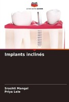 Implants InclinéS Priya Lele