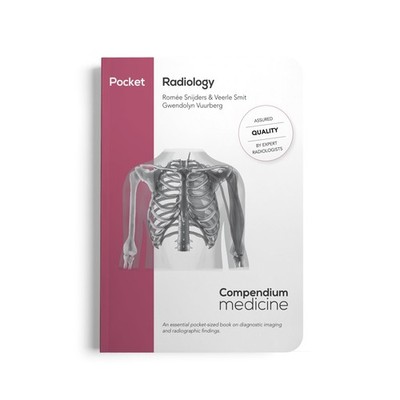 Pocket Radiology : essential pocket-sized book diagnostic imaging & radiographic