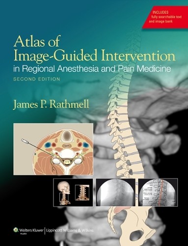 Atlas of Image-Guided Intervention in Regional Anesthesia and... - 9781608317042
