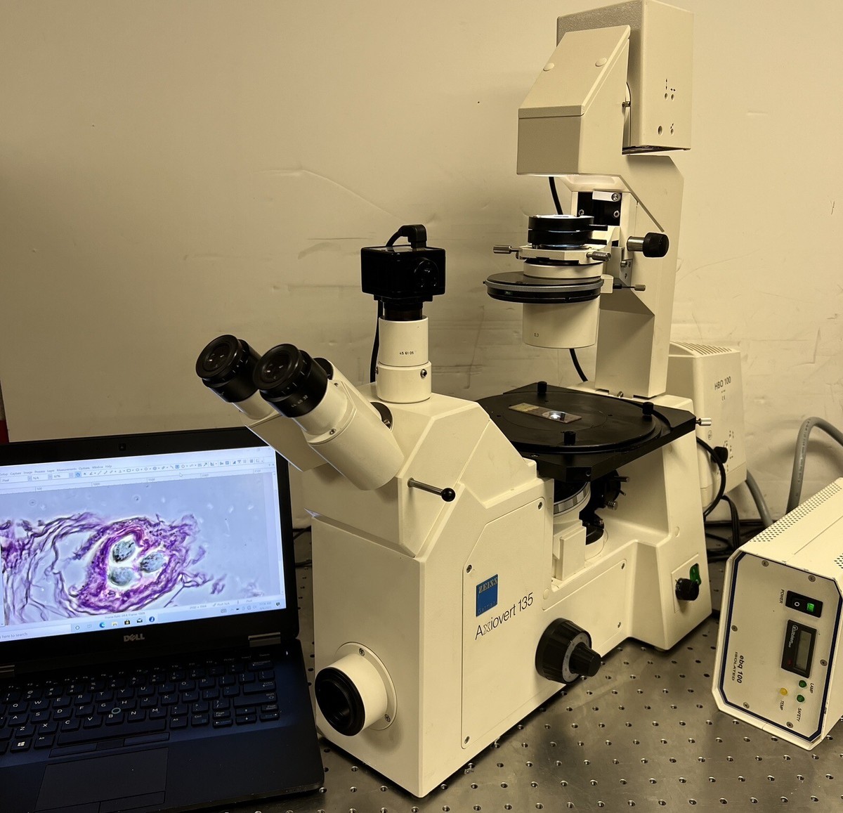 Zeiss Axiovert 135 Inverted Fluorescence Phase Microscope Zeiss Axiovert 135 Inverted Fluorescence Phase Microscope