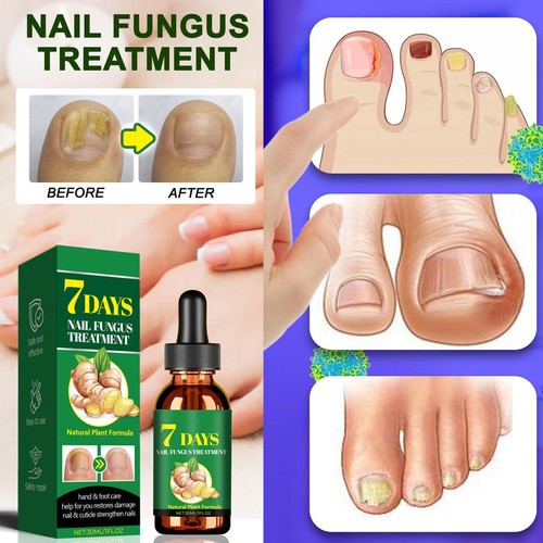 Nail Strengthener Oil Lightweight Natural Nail Gel 30ml Natural - Picture 3 of 12