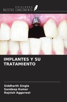 Implantes Y SU Tratamiento Rajnish Aggarwal