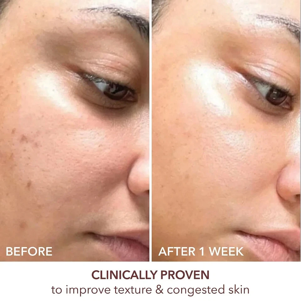 NUEVO Dr. Dennis Gross Retinol Avanzado + Suero Renovador Ferúlico/100% AUTÉNTICO Foto 2 de 4