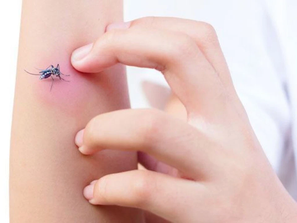 Mopiko Ointment 20g Mosquito bite / insect bite inchines Kids and Adults - Image 4 of 4