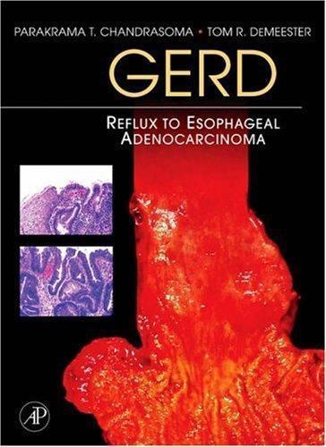 GERD Reflux to Esophageal Adenocarcinoma Chandrasoma DeMeester Hardback