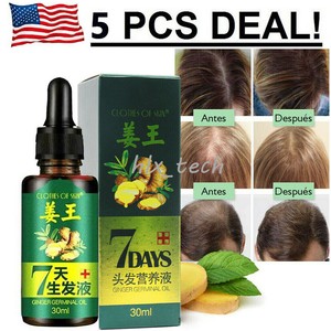Fast 7 Days Hair Growth Essential Oil Loss Natural Ginger Ginseng