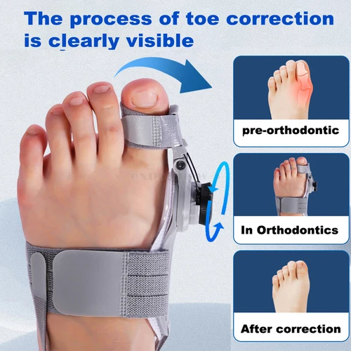 Bunion Fix Toe Valgus Corrector Big Toe Straightener for Men & Women - Picture 2 of 28