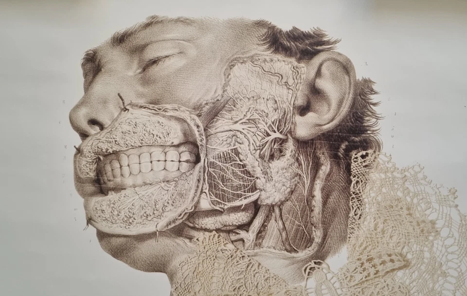 Daniel Spoerri - Serigrafia firmata e numerata - Edizione soli 10 esemplari - Immagine 4 di 4