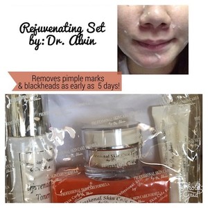 dr alvin whitening set