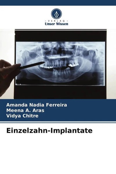 Amanda Nadia Ferreira (U. A.) | Einzelzahn-Implantate | Taschenbuch | Deutsch-image