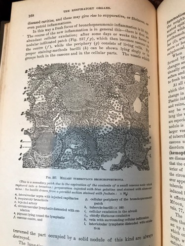 Textbook of Pathological Anatomy part 3 (1887) Wood’s Library, Antique Medical - Picture 16 of 18