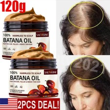 2 Batana Oil Conditioner for Hair Growth,Anti Hair Loss,Healthier Thicker Fuller