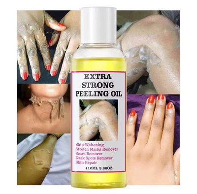 Strong Yellow Peeling Oil Exfoliating Solution for Face Body Dark Skin Knuckles