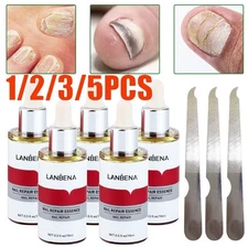 5/3x LANBENA Nail Repair Essence Remove Onychomycosis Serum Fungal Treatment Toe