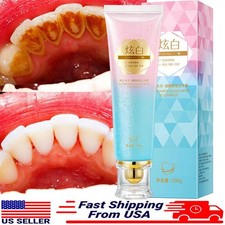 Niacinamide Whitening Toothpaste,Natural Niacinamide Toothpaste,Teeth Whitening