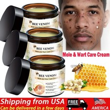 Bee Venom Skin Tag Removal Treatment Cream Body Care Mole Corn Wart Remover
