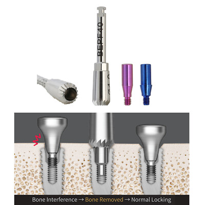 Dental Implant ET Bone Profiler 4.0 Guide Screws Mini Regular Hiossen OSSTEM