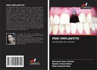 Peri Implantite Navneet Kour Mehta