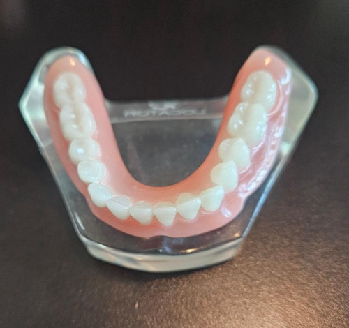 Zest Locator Overdenture Models - 2 Implants Lower- Includes LOCATOR and LINERS