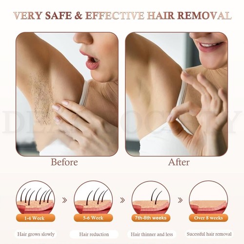 Laser Hair Removal for Women and Men IPL Hair Removal with Ice Cold Function - Picture 3 of 7